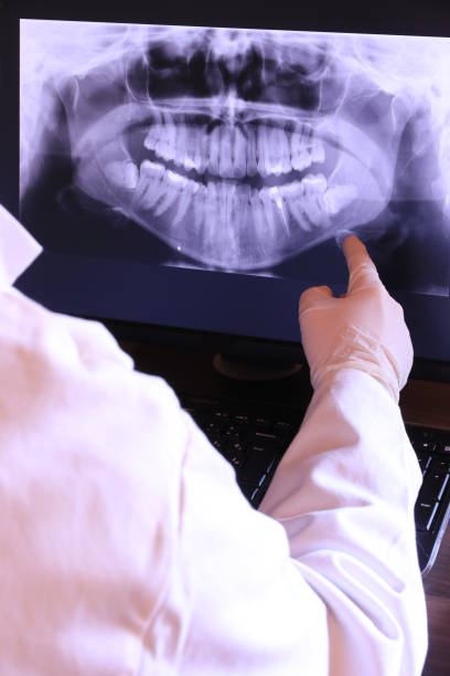 Best Emergency Dental Care for Broken or Chipped Teeth in English, IN